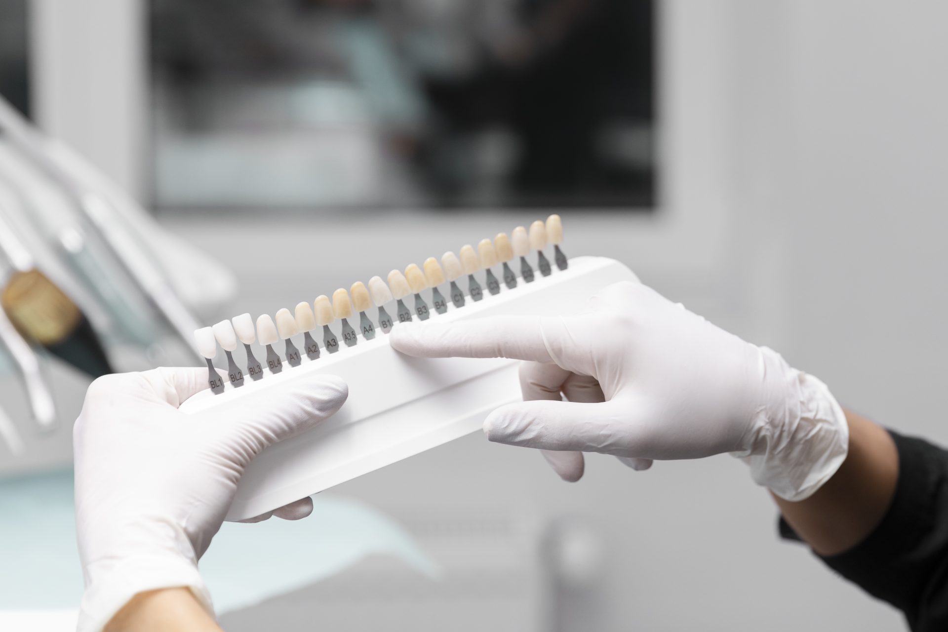 teeth whitening in widnes teeth whitening in widnes